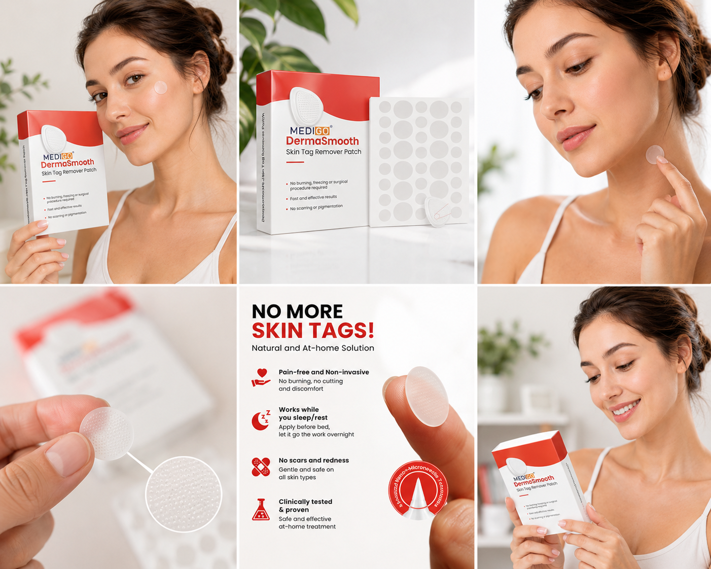 Skin Tag Remover Patches – 2 Pack